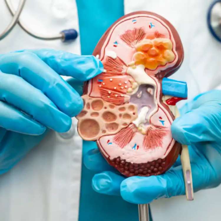 Urology & Nephrology Get Best Treatment Implant Surgeries by Brit Indo Medical Concierge for UK Europe and Canada