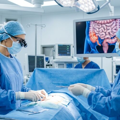 Appendix Surgery Treatment by Brit Indo Medical Concierge