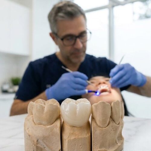 Dental Braces & Cap Treatment